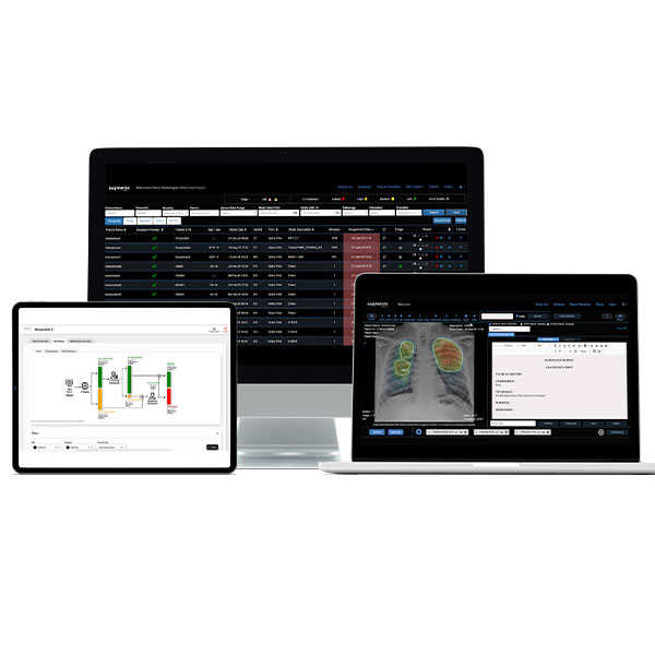 DeepTek Augmento – AI Powered Radiology Workflow & Cloud PACS Platform